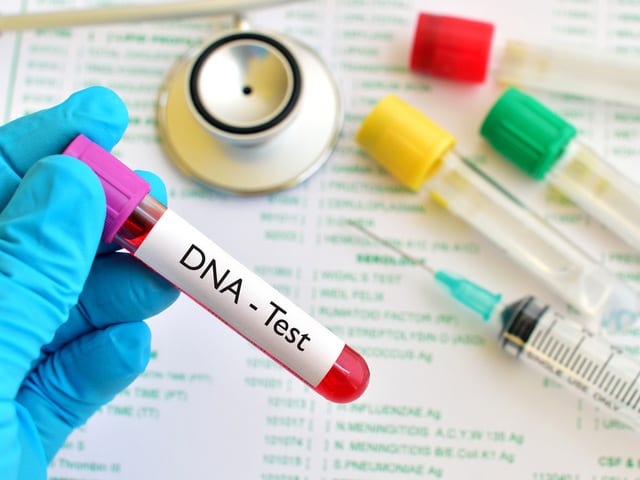 Are DNA Testing Kits Safe to Use?